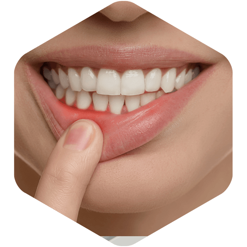 Smile showing Tooth Abscess.